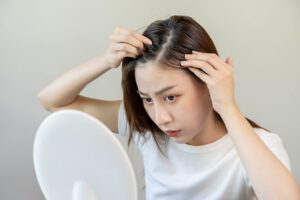 生え際が気になっている女性